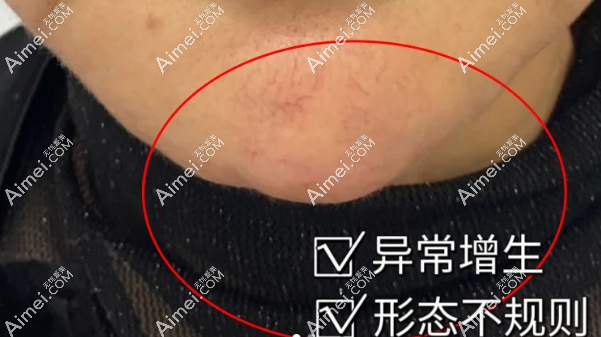 周云超取出异物干净 周云超取出异物干净