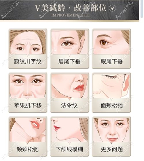 北京面部提升好的医生排名前十 北京面部提升好的医生排名前十