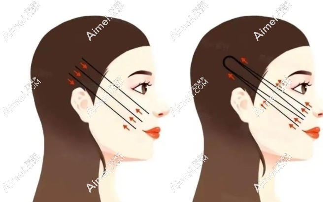 2025成都筋膜提升医院排名:素美|懿和唯美|恒博天姿筋膜提升三件套做的好(均价39800元起) 爱美网 2025成都筋膜提升医院排名:素美|懿和唯美|恒博天姿筋膜提升三件套做的好(均价39800元起) 爱美网