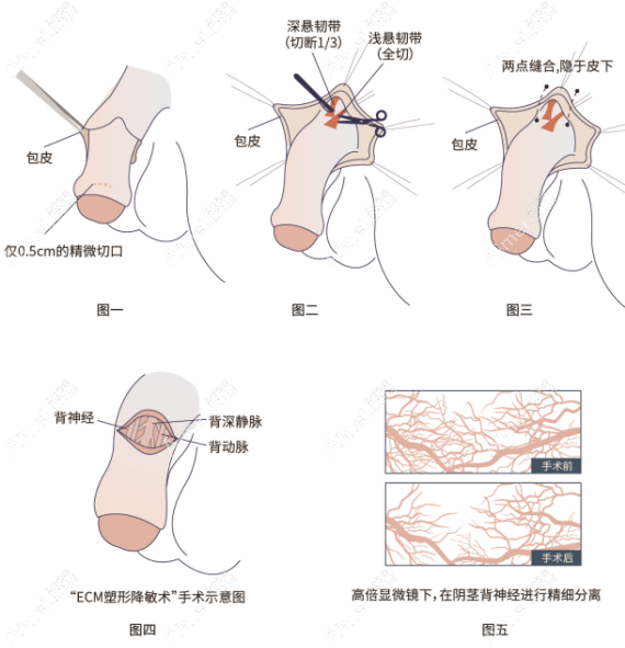 李世荣生殖器整形费用6.8万元起，真人找重庆星荣李世荣做隐痕阴茎延长2-5cm，靠谱！