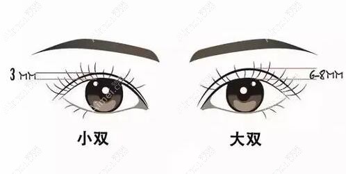 杭州张霞飞双眼皮做得怎么样？张霞飞做初眼及双眼皮失败修复技术好，放心选！