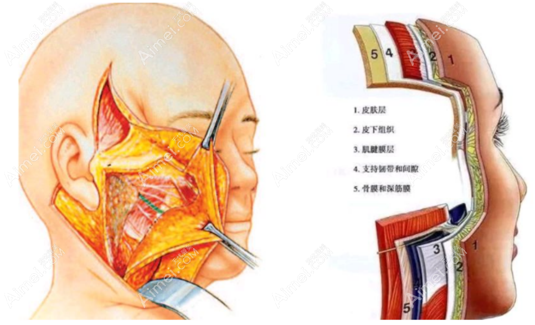 高亚东医生的拉皮手术经验 高亚东医生的拉皮手术经验