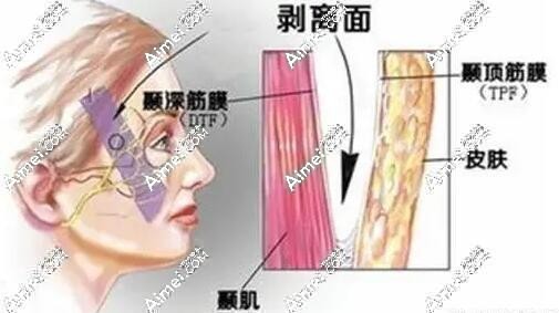 北京杨喆拉皮技术怎么样呢?杨俊在北京四季青橙医院做小拉皮技术好-价格68000元起 北京杨喆拉皮技术怎么样呢?杨俊在北京四季青橙医院做小拉皮技术好-价格68000元起
