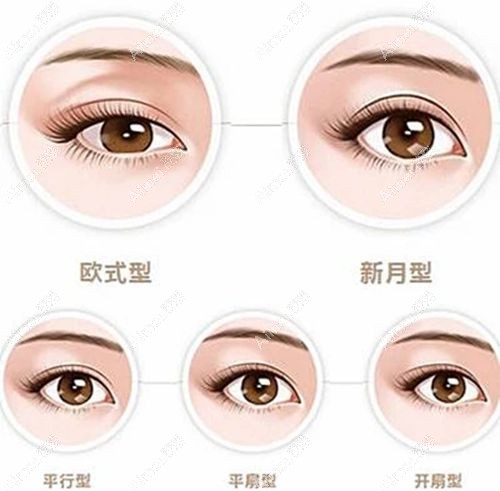 张莹莹医生做双眼皮真的好 张莹莹医生做双眼皮真的好