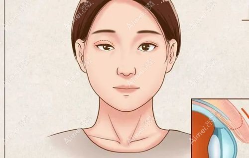 方涛医生在武汉哪家整形医院坐诊?方涛在武汉颜范薇美修复双眼皮,地址在洪山区珞瑜路