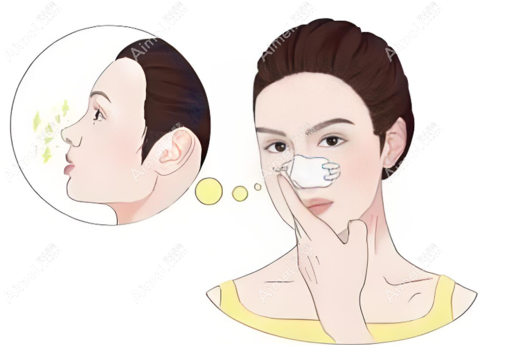 周柯做鼻修复的口碑评价 周柯做鼻修复的口碑评价