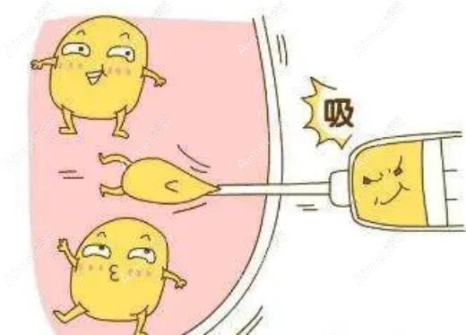 广州抽脂减肥好的整形医院排行榜：优选广州正规吸脂十大整形医院，美莱上榜！