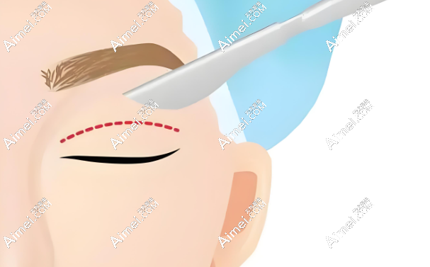 眼部整形 眼部整形