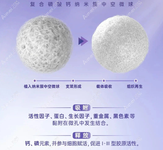 悦龄塑注射填充的优势 悦龄塑注射填充的优势