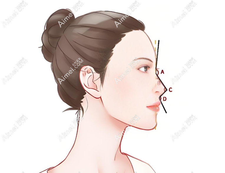 上海做网红鼻子比较好的医生排名前十顶牛榜,范荣杰/沈国雄/李健前三无争议