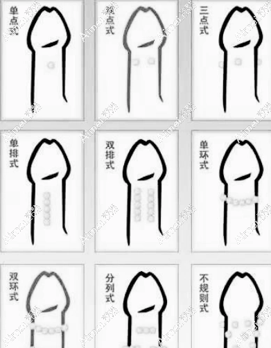 别再花冤枉钱!男科医院男性入珠手术在线问诊0元享 别再花冤枉钱!男科医院男性入珠手术在线问诊0元享