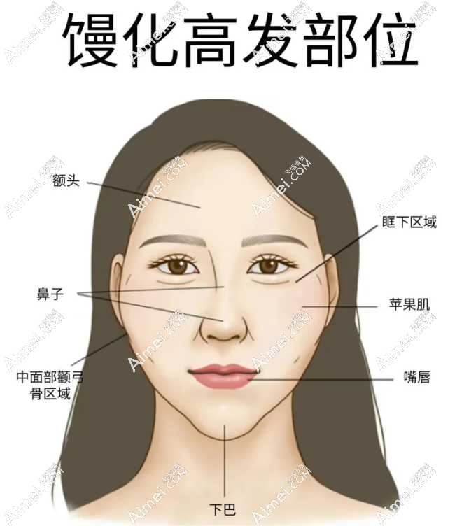 北京王阔远医术获赞无数,尤其治疗馒化脸成效惊艳,不容错过哟!