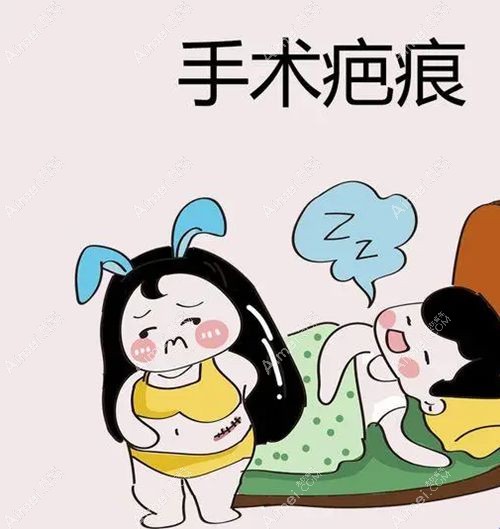 上海疤痕修复医院10强名单:优选除疤费用不贵性价比高的10家医院(祛疤500元起)