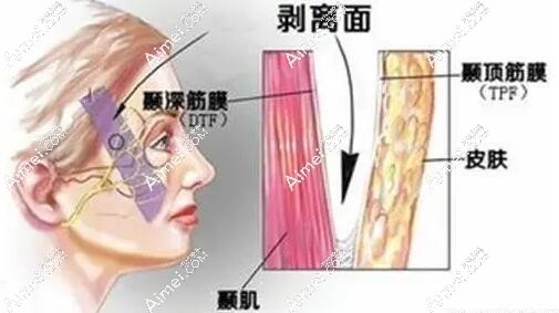 2025北京面部筋膜提升医生排名榜汇总！黄寅守/李晓东/杨大平人气高排前三，技术YYDS