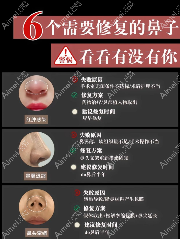 北京鼻修复www.dlren.com 北京鼻修复www.dlren.com