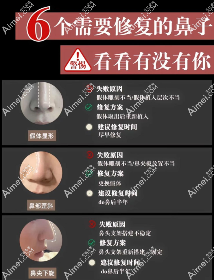 【2025年北京鼻修复医院排名前十名】术后鼻型“美到犯规”,整友:这10家后悔没早做!