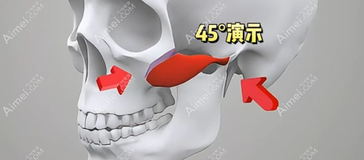 重庆磨骨好的医生 重庆磨骨好的医生