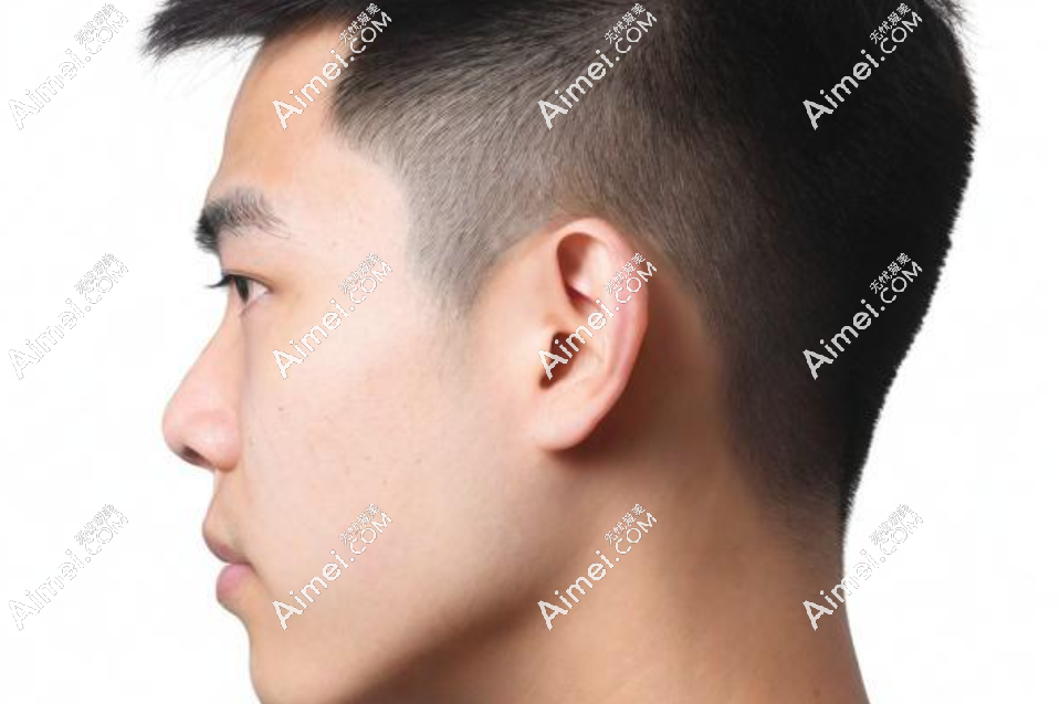 成都耳朵整形医生前top 6助你逆袭!段伟强、于晓波等六大医生全解析,耳畸形不再怕! 成都耳朵整形医生前top 6助你逆袭!段伟强、于晓波等六大医生全解析,耳畸形不再怕!