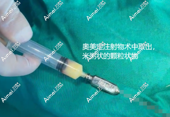 周云超取奥美定评价 周云超取奥美定评价