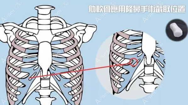 长春做肋骨鼻好的医院排名榜top10：奥拉克、中妍医院实力上榜，技术与正规性兼备