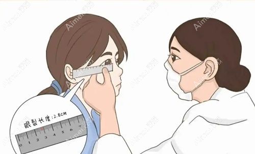 成都提肌双眼皮面诊全流程 成都提肌双眼皮面诊全流程