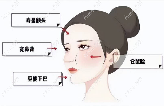 成都修复面部馒头化好的医生推荐：谢雯、朱慧东等是成都馒头脸修复好的排名前十医生