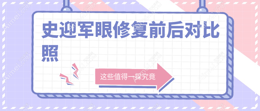 史迎军眼修复前后对比照大公开！这双眼皮修复成效“妈生感”十足，忒自然了