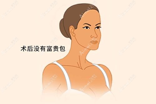 国内微创富贵包手术医院top5技术对比 国内微创富贵包手术医院top5技术对比