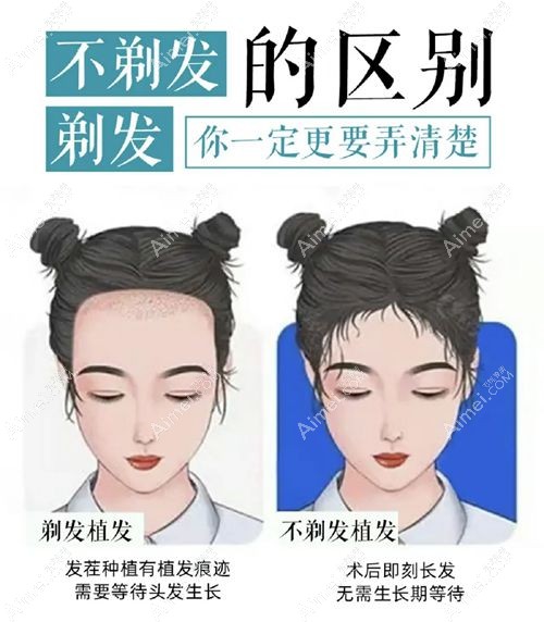 为什么选择大麦微针植发医院 为什么选择大麦微针植发医院