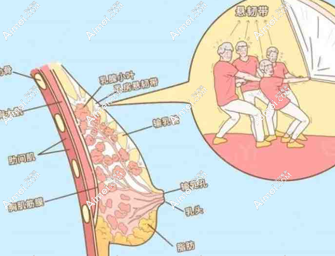 2025胸部韧带提升术价格揭秘:轻中度5千起,重度5万起 2025胸部韧带提升术价格揭秘:轻中度5千起,重度5万起