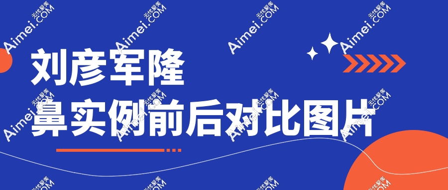 刘彦军隆鼻成功概率高达97.6%,素人塌鼻逆袭“妈生鼻”前后对比图曝光!