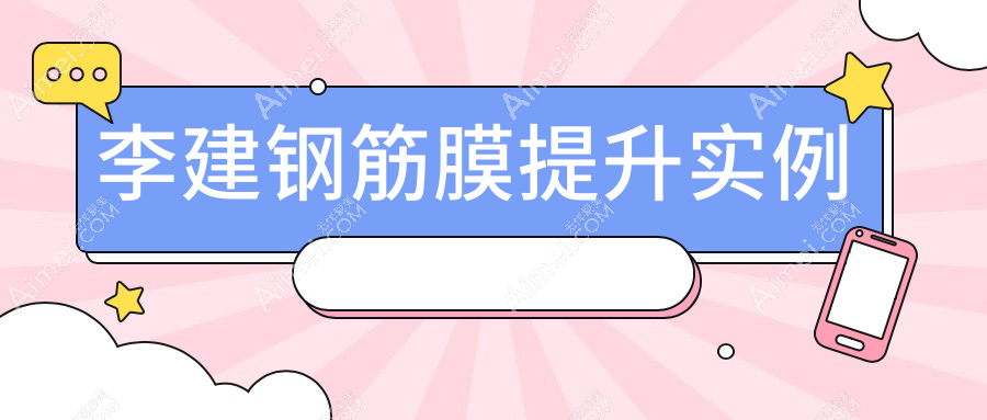 李建钢筋膜提升实例