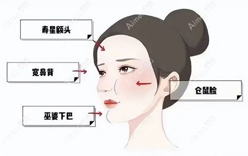 2025国内馒化修复口碑好的医生排行榜（top3王阔远/周云超/钟杰光），口碑载道，好评如潮
