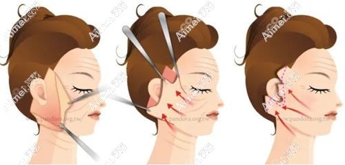 40+拉皮必藏，上海倪锋医生坐诊一览表：坐诊医院-坐诊时间-擅长项目-收费标准全公开