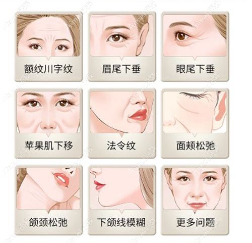 王召东的筋膜固定是正规的吗 王召东的筋膜固定是正规的吗