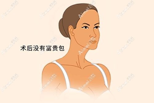 20250307602739.jpg 富贵包手术3.jpg