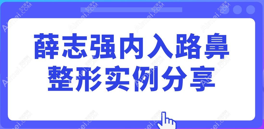 薛志强内入路鼻整形实例分享,术后3个月宛若天生,网友:这美商绝了
