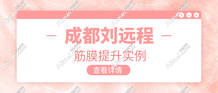 成都刘远程筋膜提升实例测评:30 岁做太早?术后轮廓立体,面部皮肤紧致