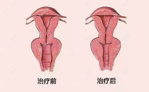 广州私密整形专科如何就诊预约 广州私密整形专科如何就诊预约