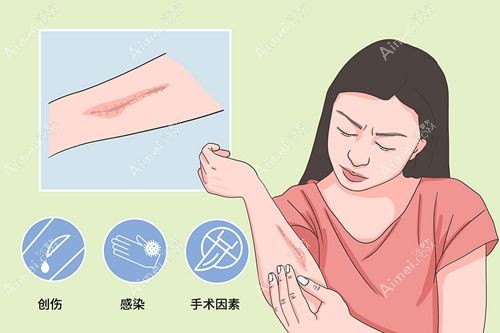 武汉治疗疤痕疙瘩好的医院如何选 武汉治疗疤痕疙瘩好的医院如何选