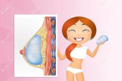 济南假体隆胸好的医院排名（2025新版）：8家实力强、口碑好的正规机构