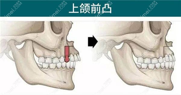 李继华医生手术项目与价格参考 李继华医生手术项目与价格参考