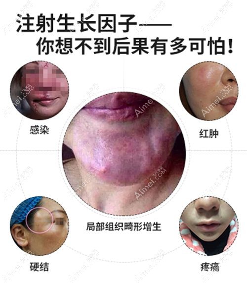 上海取生长因子口碑好的医院推荐!排名前五,技术靠谱,取出干净又安心