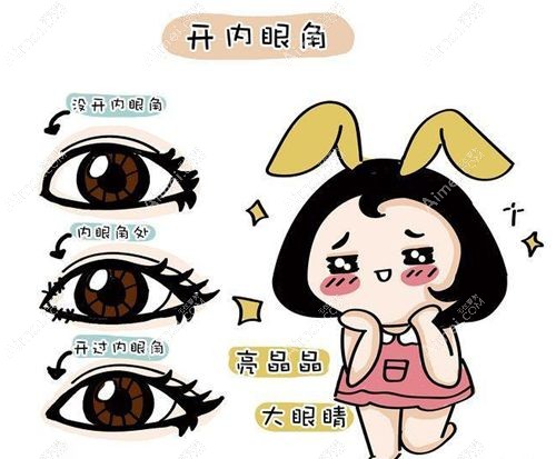 魏志香和张冰洁内眼角修复技术大 PK 魏志香和张冰洁内眼角修复技术大 PK