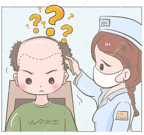 男士发际线种植多少钱?8-12元/毛囊,种植1500/2500/3000毛囊单位1-4万