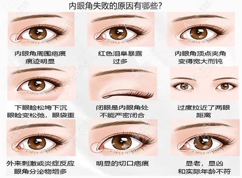 魏志香和张冰洁哪个修复内眼角好？高难度修复技术、口碑大 PK！附术后自然度评分