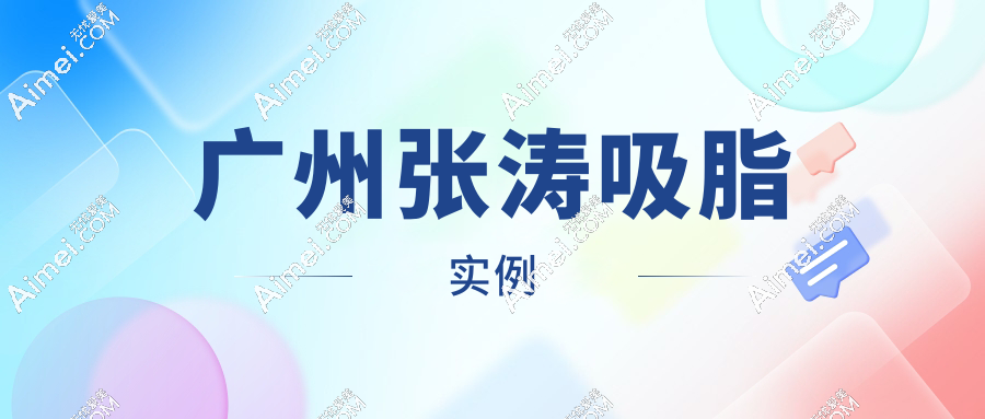 广州张涛吸脂实例