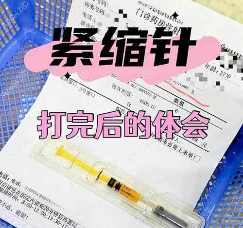 深圳打紧缩针的实用指南 深圳打紧缩针的实用指南
