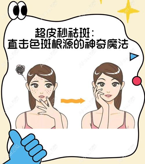 激光祛斑价目表 激光祛斑价目表