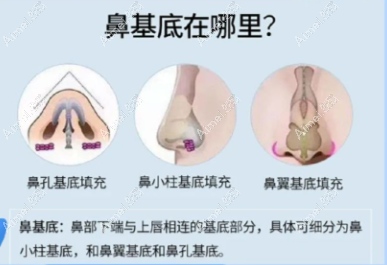 鼻基底填充 鼻基底填充